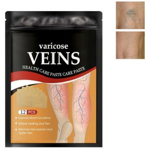 Parche Varices